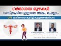 ഗർഭാശയ മുഴകൾ ഇനി ശസ്ത്രക്രിയ ഇല്ലാതെ നീക്കം ചെയ്യാം | Fibroid Treatment Malayalam