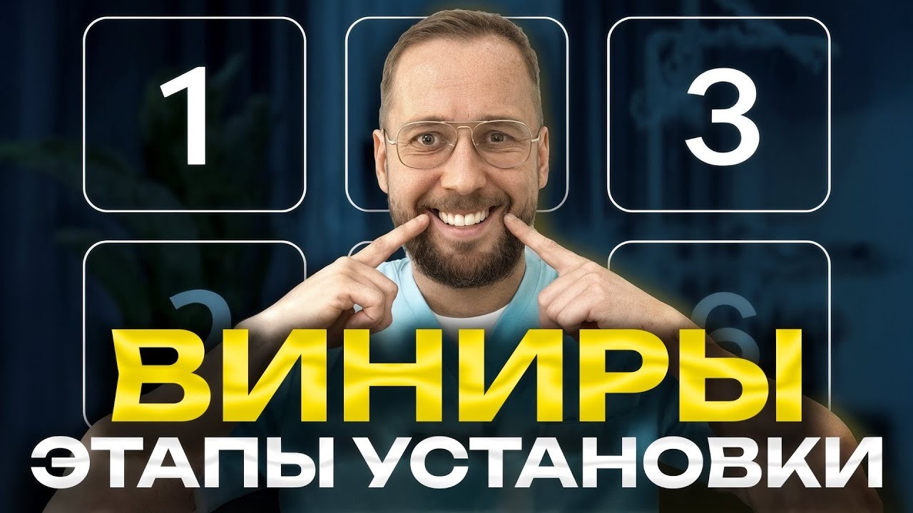 Процесс установки виниров. Что Вас ждёт? [ШАГ за ШАГом]