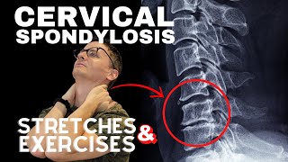 Cervical Spondylosis (Neck Arthritis) Stretches & Exercises | Dr. Jon Saunders