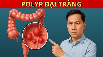 Polyp Đại Tràng, Ăn gì Kiêng gì để không thành Ung thư Đại tràng