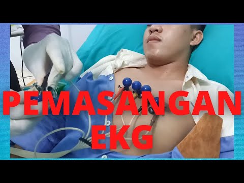 Video: Cara Memasukkan ECG di Dada: 15 Langkah (dengan Gambar)