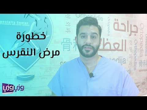 خطورة مرض النقرس