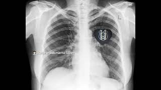 Sen Her Şeyimsin Beşiktaş❤️