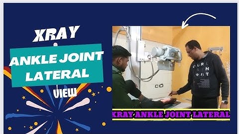 X RAY ANKLE LATERAL VIEW #ankle #jointpain #lateral #view #views #projection #interpretation #xray
