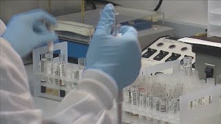 Kern County Public Health raises awareness for Valley fever