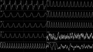 [OG] ES1869F test