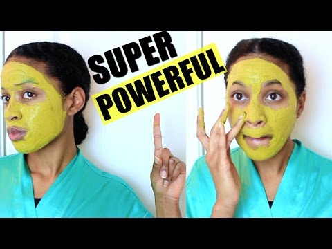 DIY POWERFUL Turmeric Face Mask|Best Acne Treatment & Fades Scars (Get Clear + Brighten Skin)