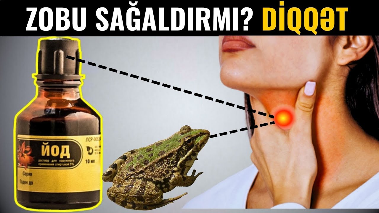 YOD ZOBU SAĞALDIR? - Zobun Əlamətləri və Müalicəsi