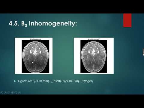 Bilkent University - EEE 473 Medical Imaging - Term Project Presentation