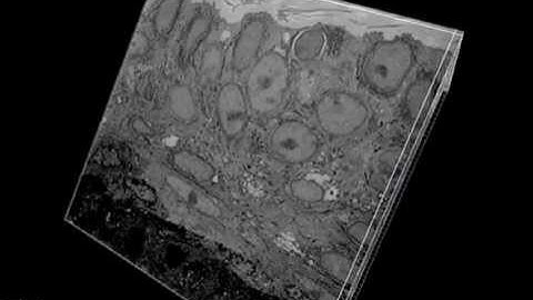 Imaging of a human skin biopsy sample