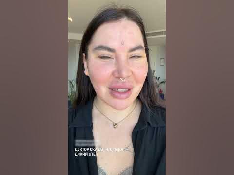 Рада Русских - лицо своей косметики - сделала круговую подтяжку лица 😉 ...