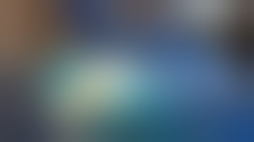 Stealth guided biopsy of right brain lesion at the Wellington Clinic Abuja.