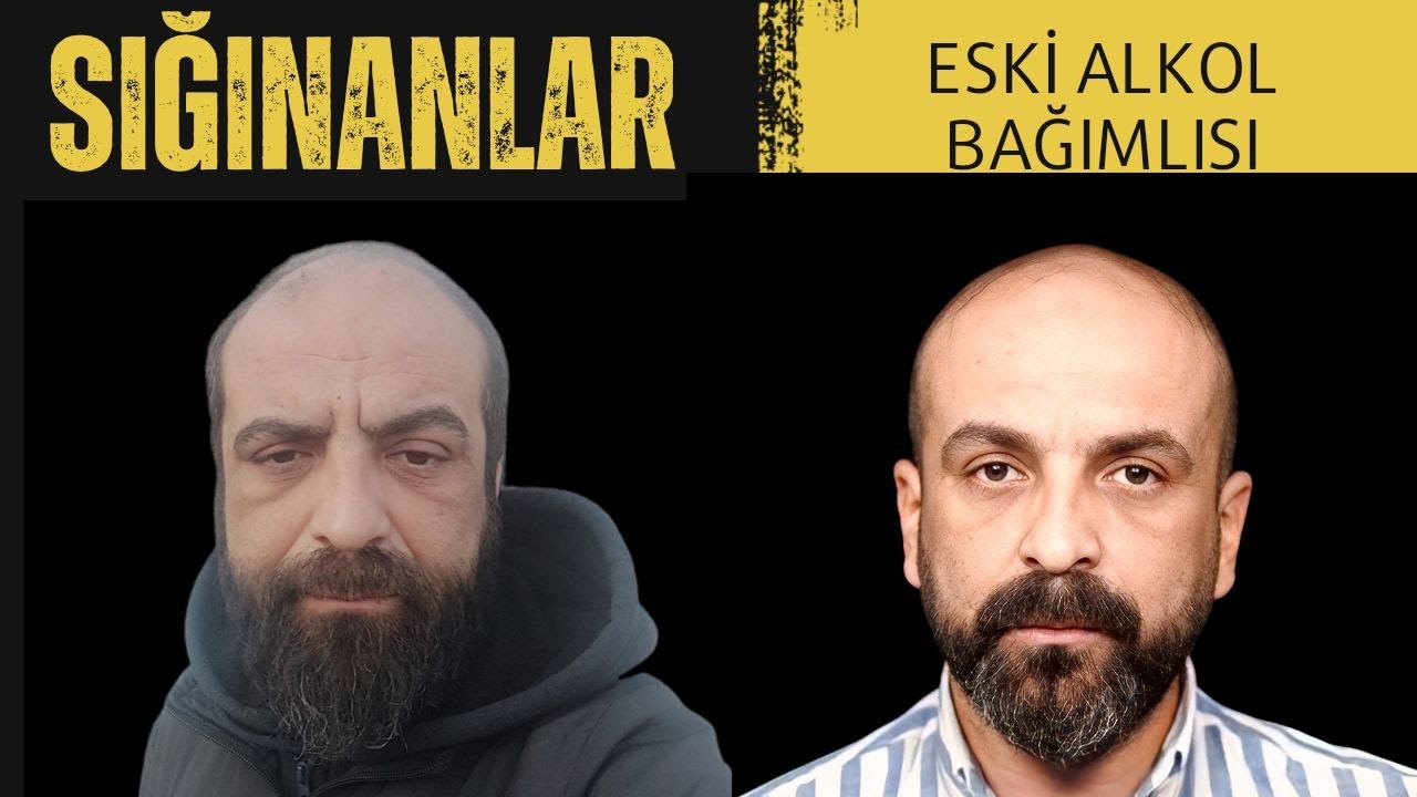 ESKİ ALKOL BAĞIMLISINDAN AĞLATAN İTİRAFLAR / ''GÜNDE 3-4 LİTRE ETİL ALKOL İÇİYORDUM''  B14