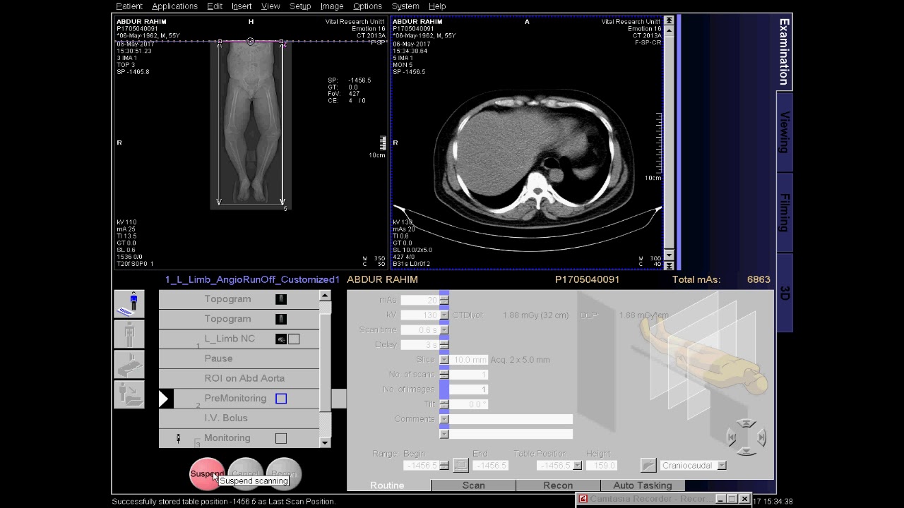 CT Lower Limb Angio Full Work Process SIEMENS In Syngo Acquisition spotlight-on-jeffrey-turner-chairman-board-of-commissioners