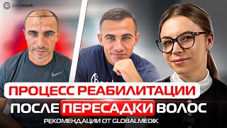 видео: Процесс реабилитации после пересадки волос картинка: Процесс реабилитации после пересадки волос