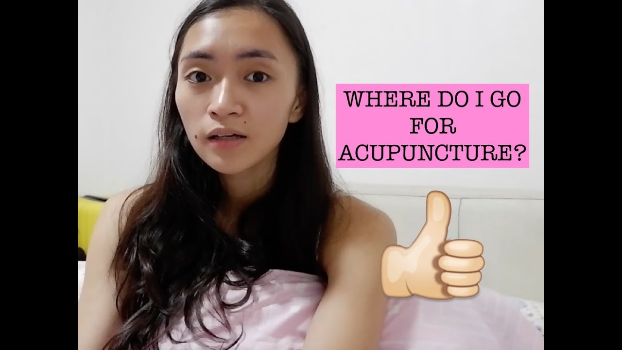 Offstage Series: Affordable & Reliable Acupuncture in Manila | Katrene San Miguel