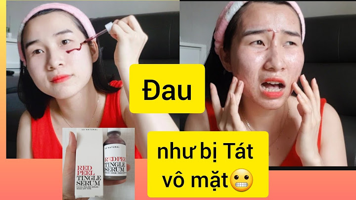 Cách sử dụng red peel review năm 2024