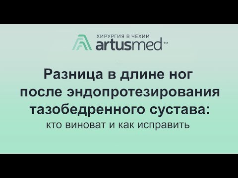 Разница в длине ног после эндопротезирования тазобедренного сустава: кто виноват и как исправить