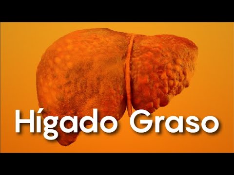 Hígado Graso- Gastrobene