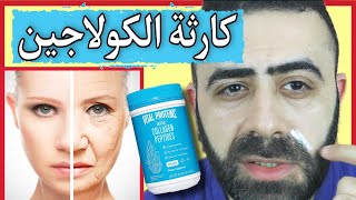 تحذير هام اياك استخدام كريم الكولاجين لشد البشرة و التجاعيد - Collagen To Get Rid Of Wrinkles