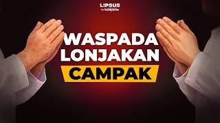 Waspada Campak Saat Mudik Lebaran, Kasusnya Naik Tajam Di Indonesia Lipsus