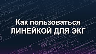 картинка: Как пользоваться линейкой для ЭКГ