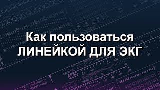 Как пользоваться линейкой для ЭКГ