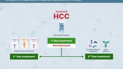Advanced HCC: treatment strategies for patients ineligible for IO or those with progression on IO