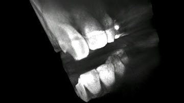 DICOM Visualization in VR