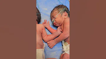 التوأم المتماثل Baby Justbeforeyousayido Explore اكسبلور 