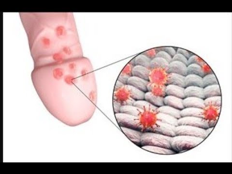 daftar-obat-salep-untuk-kelamin-luka-lecet-di-apotik