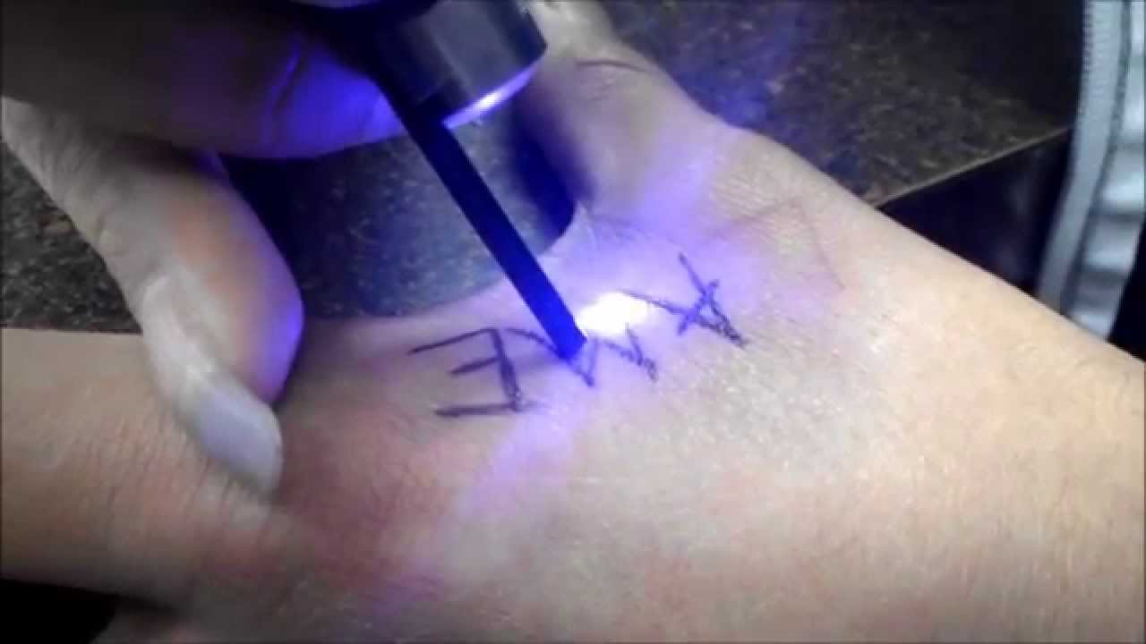 Black Tattoo Laser Branding  ViralHog  YouTube