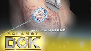 Breast Cancer | Salamat Dok