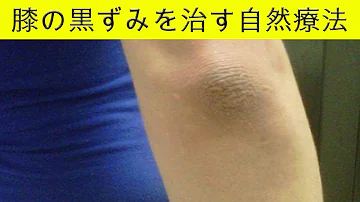 تحميل ひざひじの黒ずみの取り方 تحميل ひざひじの黒ずみの取り方