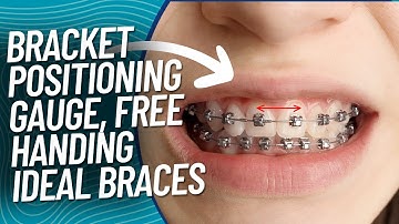 Bracket Positioning Gauge - Direct bond