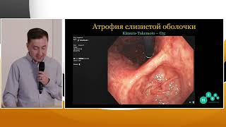 видео: 2 Валиулин ИР Применение основных протоколов по предраковым изменениям слизистой желудка в практике. картинка: 2 Валиулин ИР Применение основных протоколов по предраковым изменениям слизистой желудка в практике.