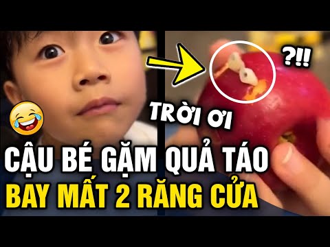 Video Rụng '2 RĂNG CỬA' sau khi cạp quả táo, 'BIỂU CẢM' của... - youtube