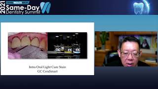 Creating an Anterior Crown with Dr. Yao-Lin Tang