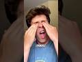 Why Rubbing Your Eyes Is More Dangerous Than You Think 