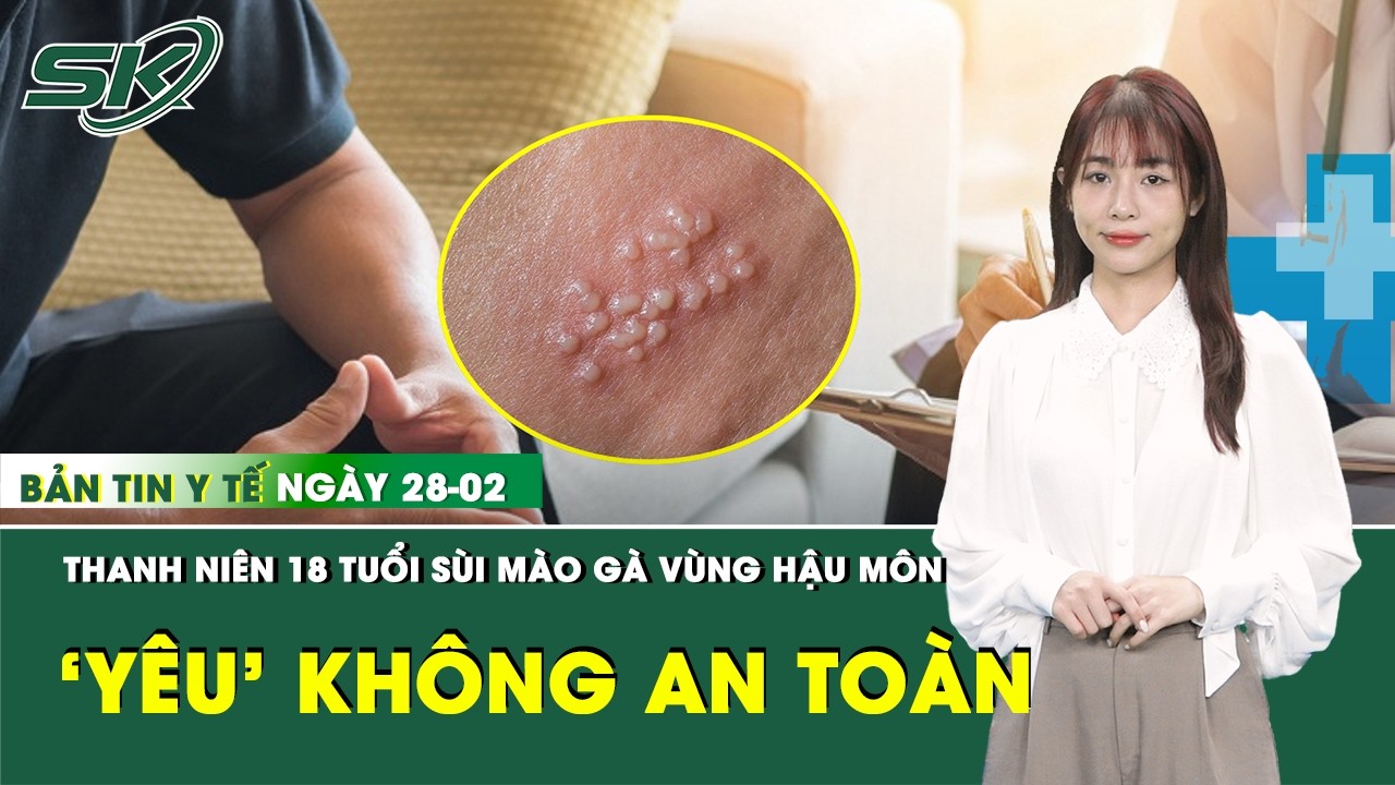 Bản Tin Y Tế 28/2: Quan hệ không an toàn, nam thanh niên 18 tuổi phát hiện sùi mào gà | SKĐS