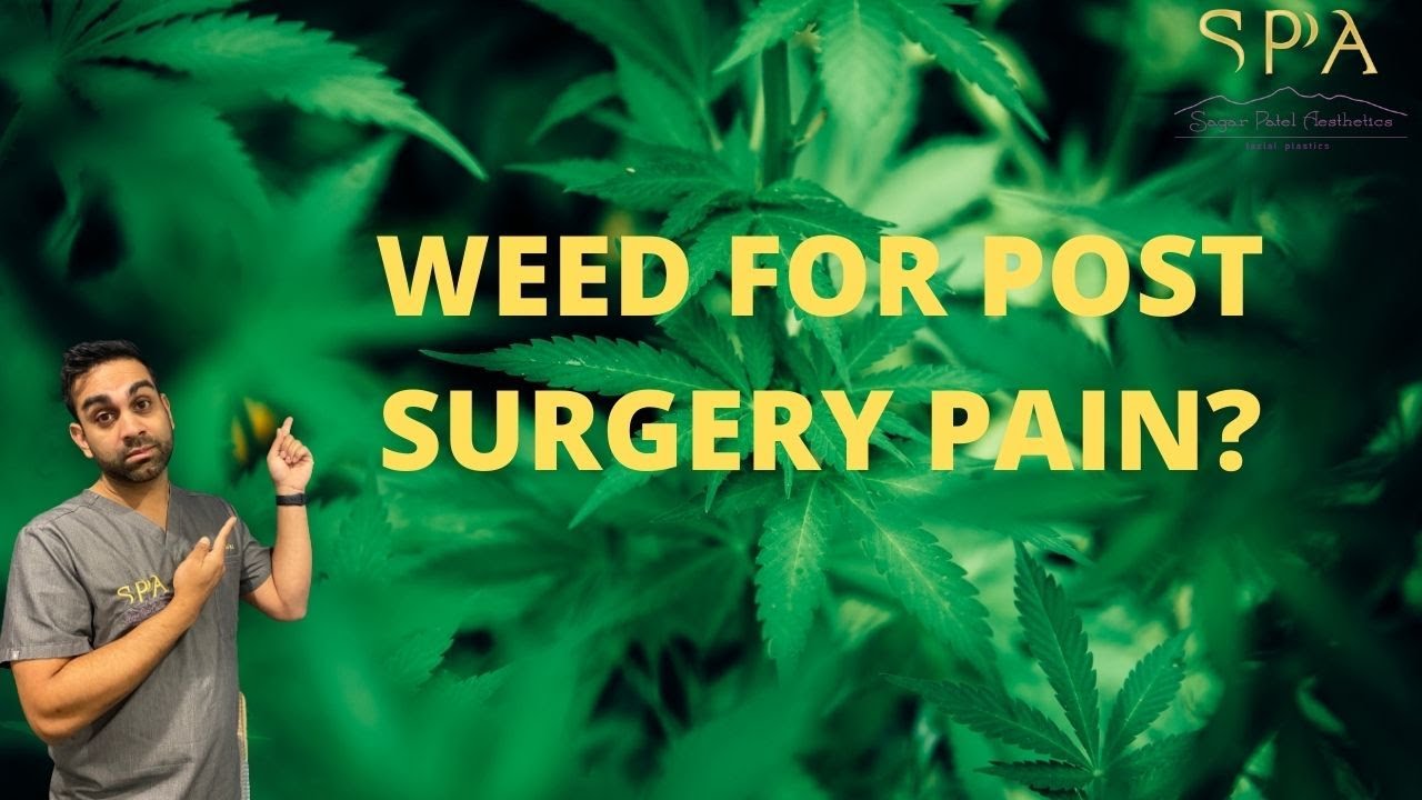 Pain After Surgery: Is Marijuana Good?