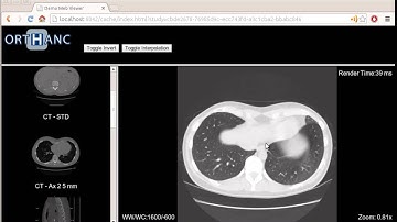 Orthanc Web Viewer Demo 1