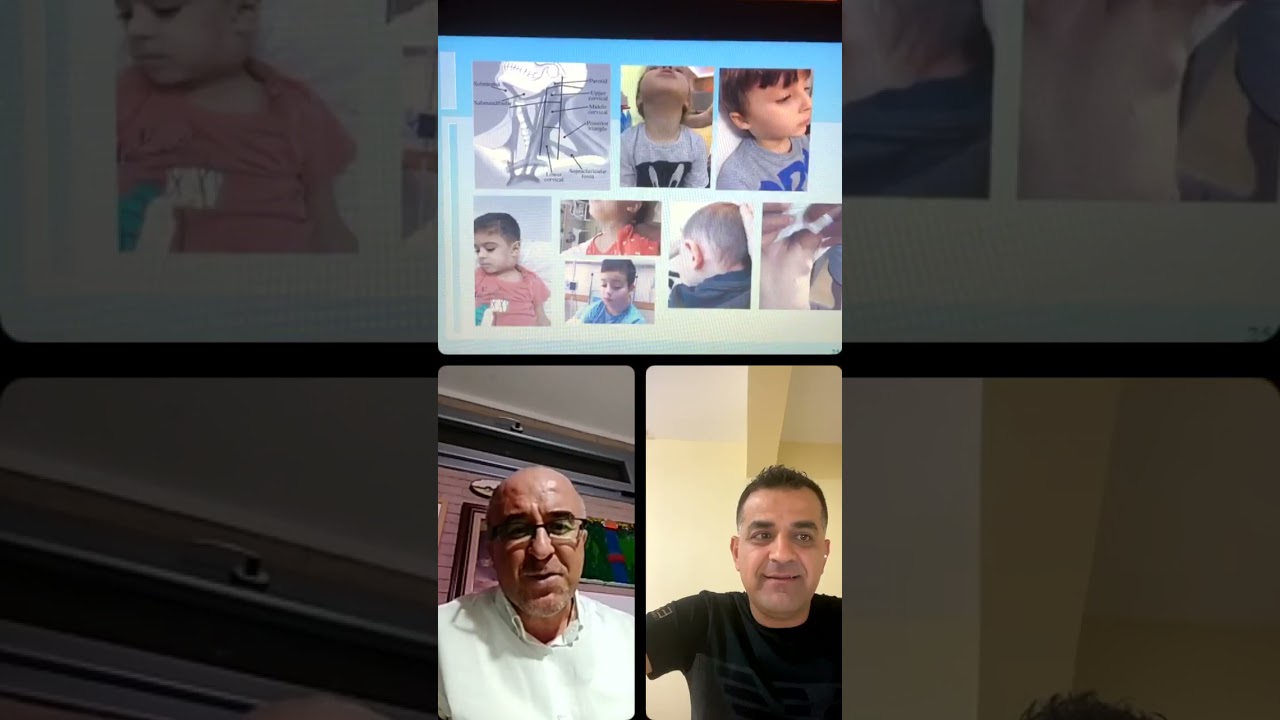 Çocuklarda Boyunda kitle, Lenfadenopatiye Yaklaşım - 04/05/2021