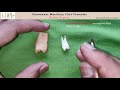 05 Distal aspect of the Maxillary First Premolar