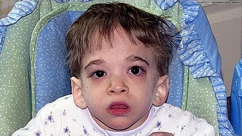 20-year-old woman trapped in child's body