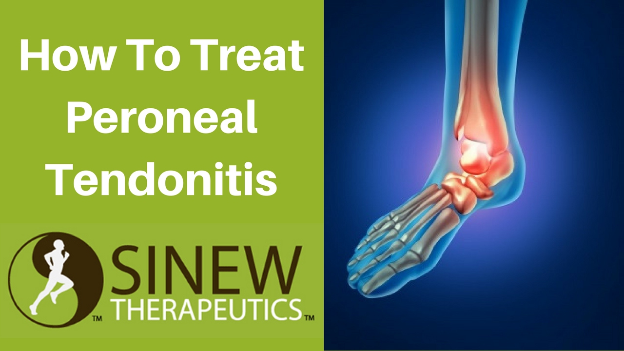 Peroneal Tendonitis Treatment