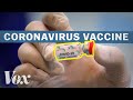 Covid-19 Vaccine Development Challenges