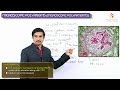 Microscopic polyangiitis (MPA) Pathology - Vasculitis USMLE Step 1