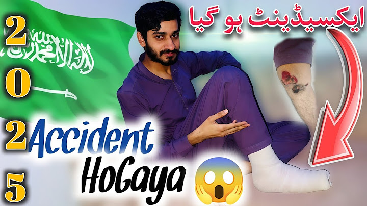 Mera accident ho gaya hai Very Dangerous😱situation