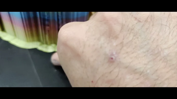 KingRoon KP5L Leveling Help